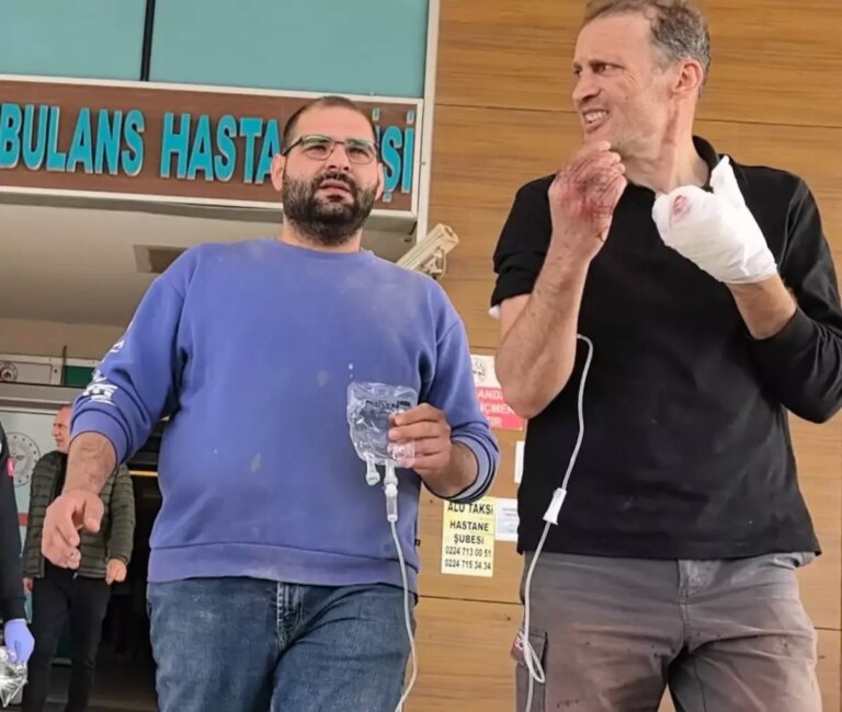 freze makinesine kaptirdigi elinden iki parmak koptu F3CZiVaV.jpg